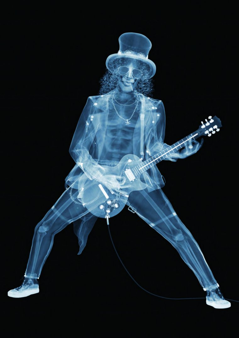 Кисть под рентгеном