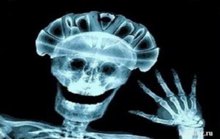 Рентгеновские снимки приколы