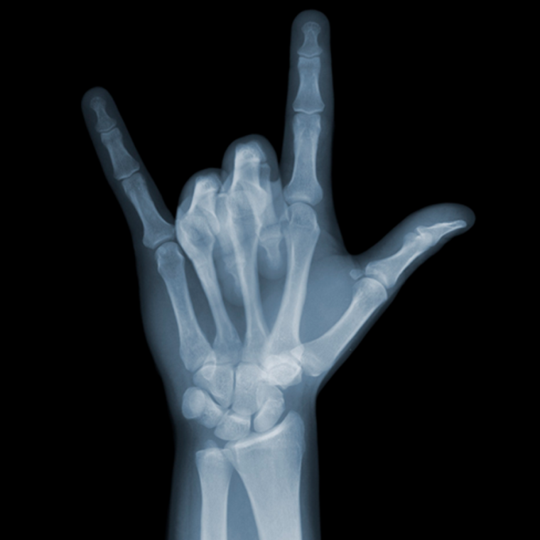 Рентгеновский снимок скелета