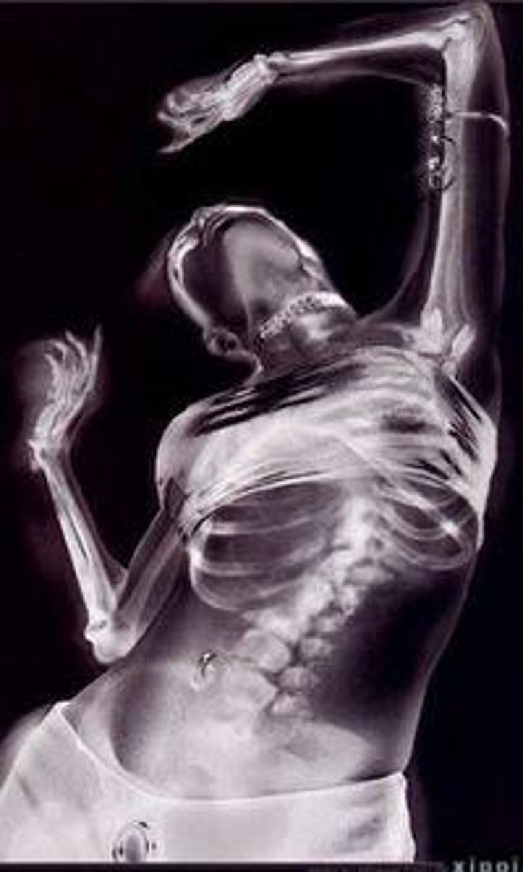 Рентгеновские снимки женщин