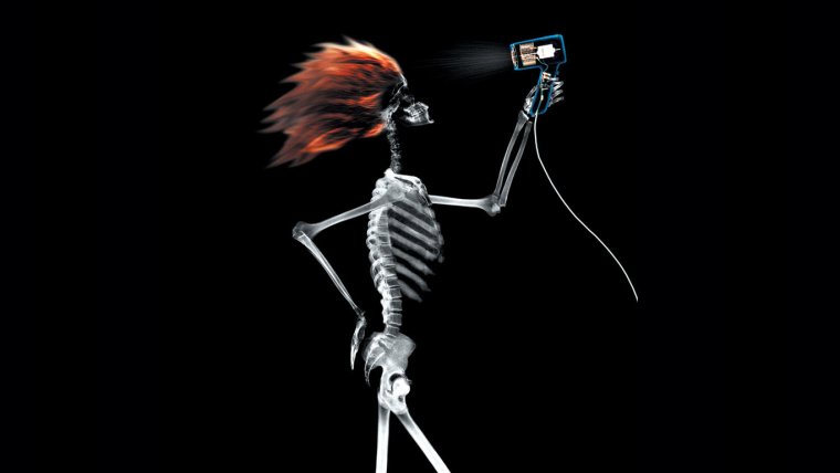 Скелет рентген