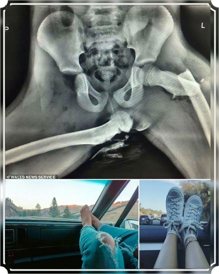 Рентгеновские снимки женщин