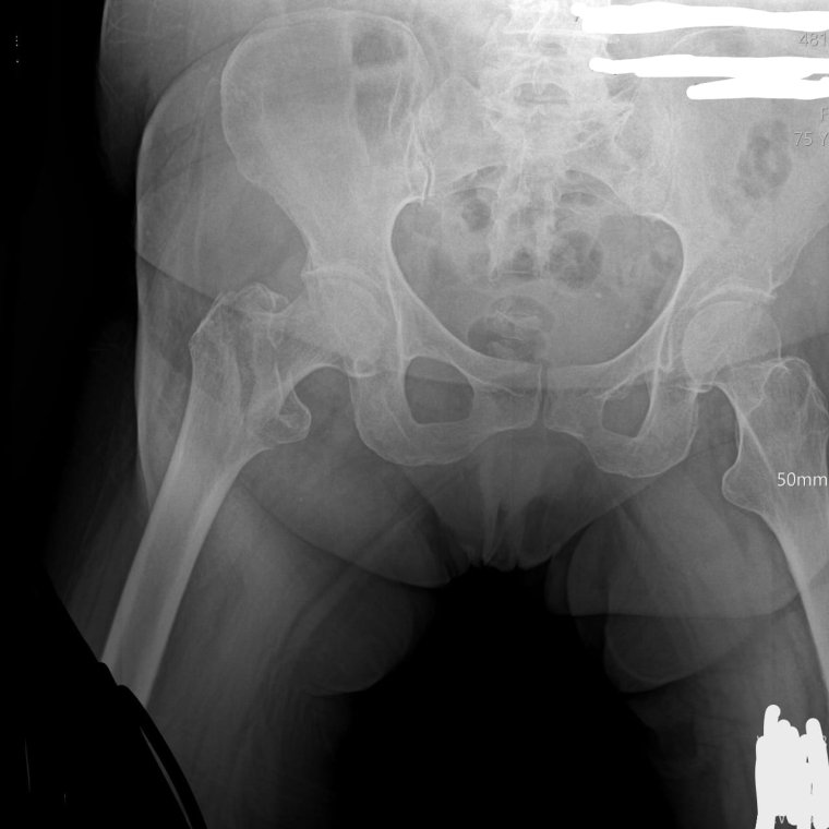 Прикольные рентгеновские снимки