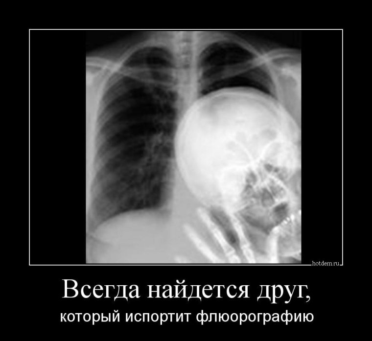 Рентгеноскопия грудной клетки здорового человека