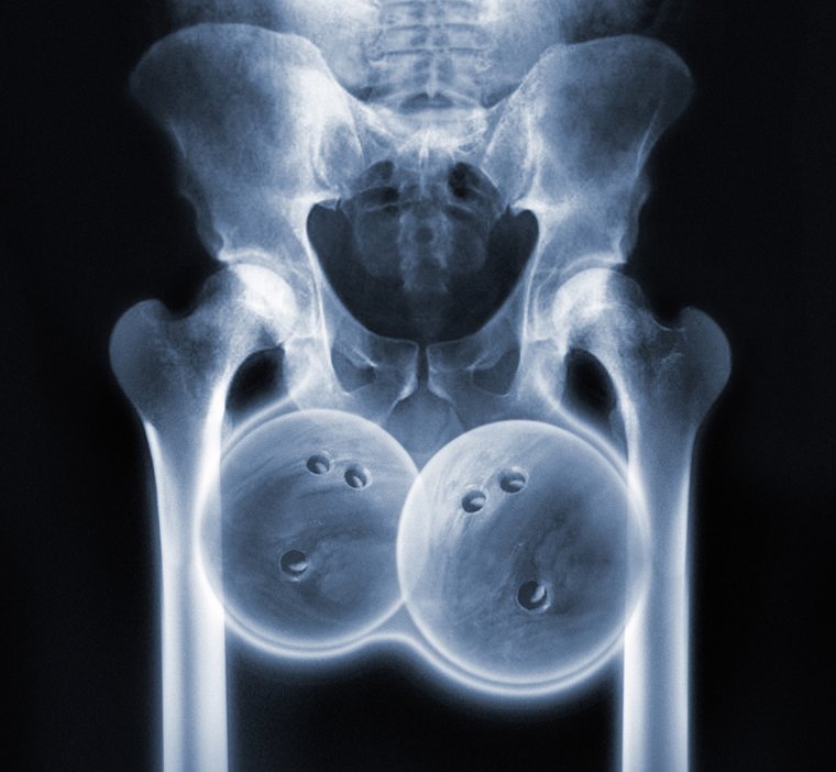 X-ray рентген скелет