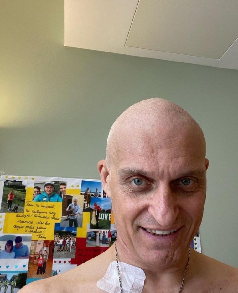 Лысина и усы