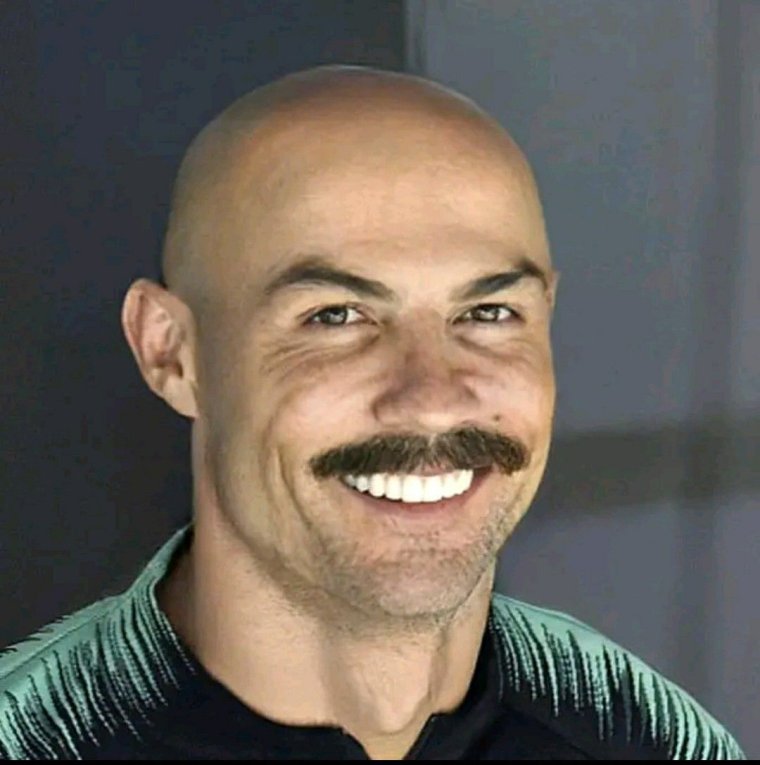 Наоми Гроссман Пеппер страдающая микроцефалией