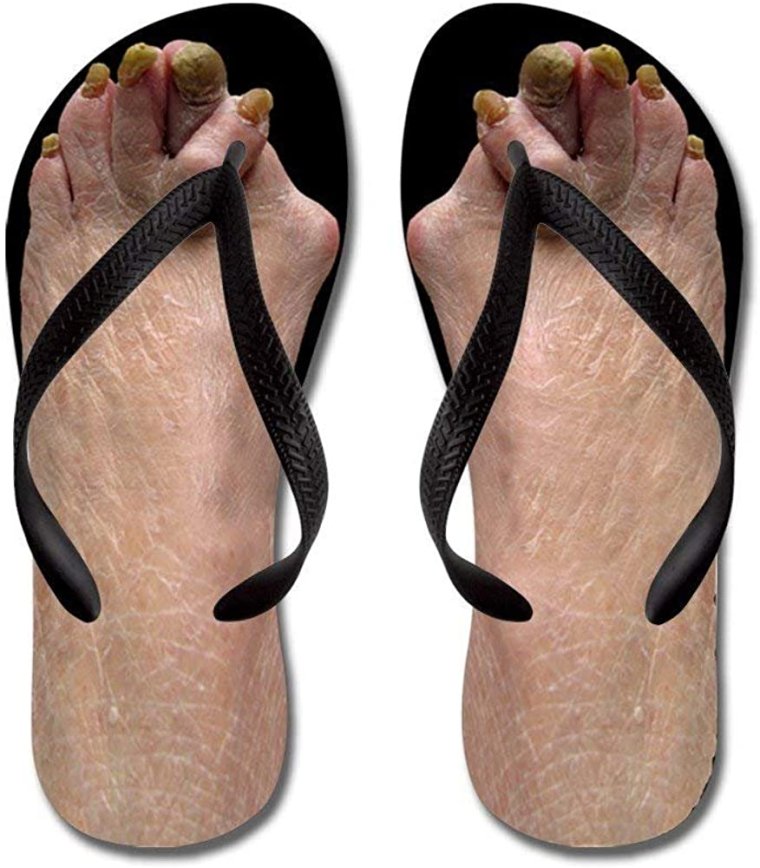 Шлепки дутые 2022