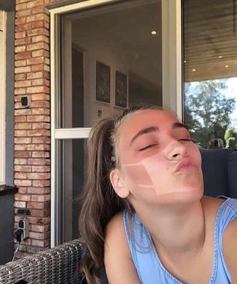 Масочный загар 2020