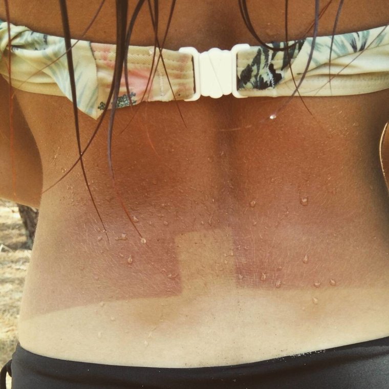 Загорелая Татуировка