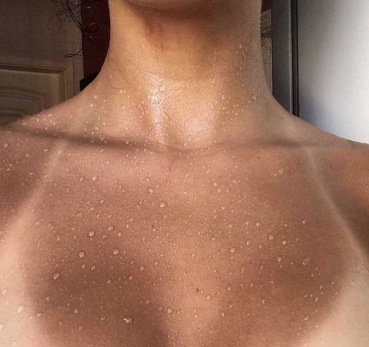 Виды загара