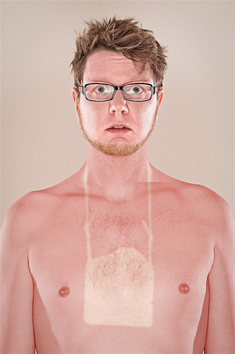 Черный загар