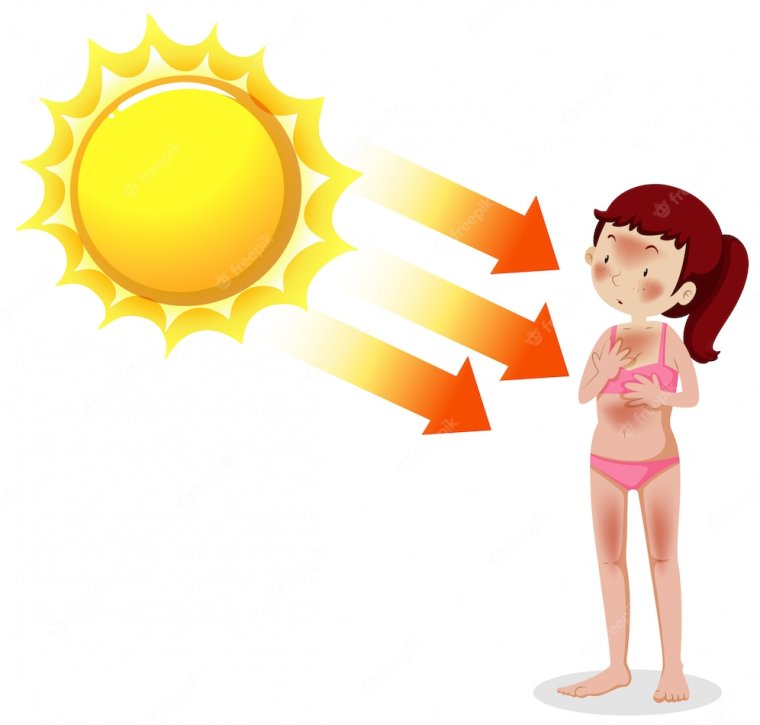 Парень обгорел на солнце