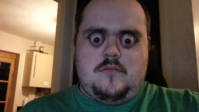 Человек с вытаращенными глазами