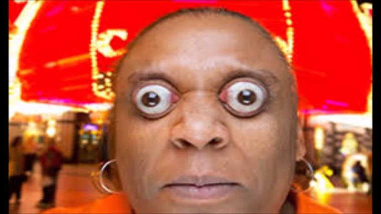 Человек с выпучими глазами