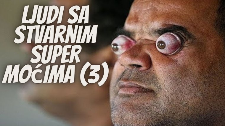 Клаудио Пинто вытаращивает глаза