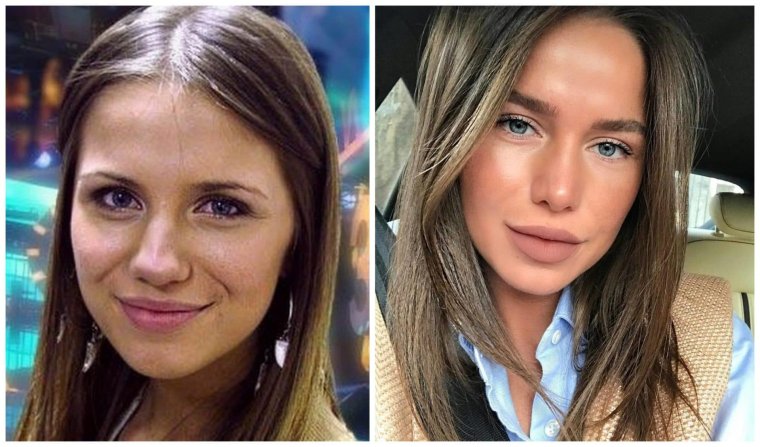 Инесса Шевчук дом 2 до пластики