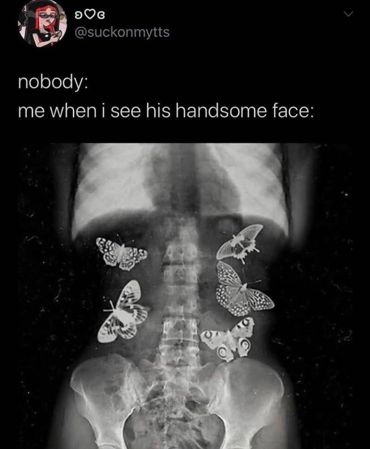 Бабочки в животе рентген