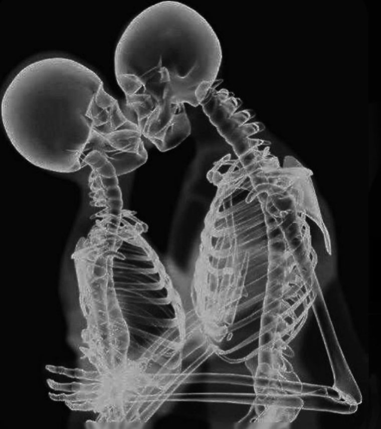 Бабочки внизу живота