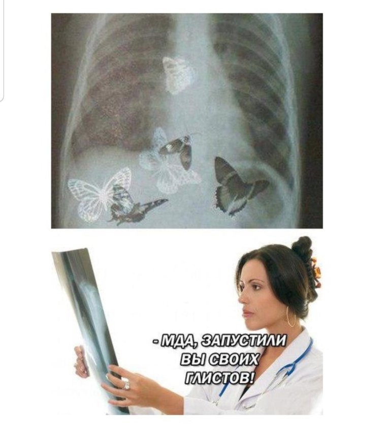 Бабочки в животе афоризмы