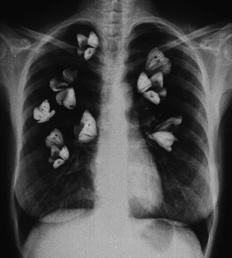 Бабочки в животе цитаты