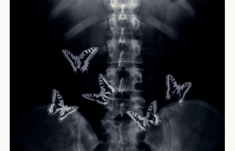 Прикольная фотосессия беременных