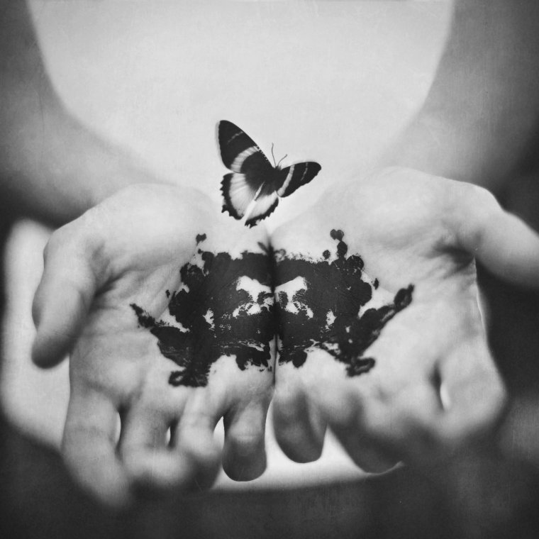 Бабочки в животе рентген