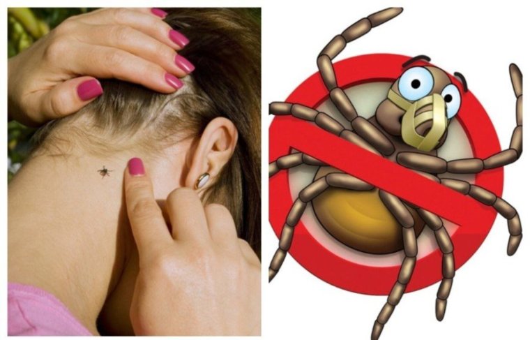 Клещи реклама