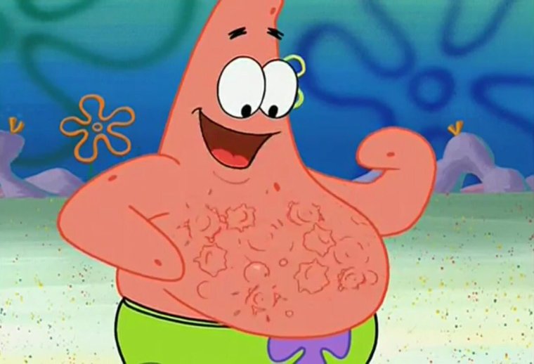 Сестра Патрика Стара