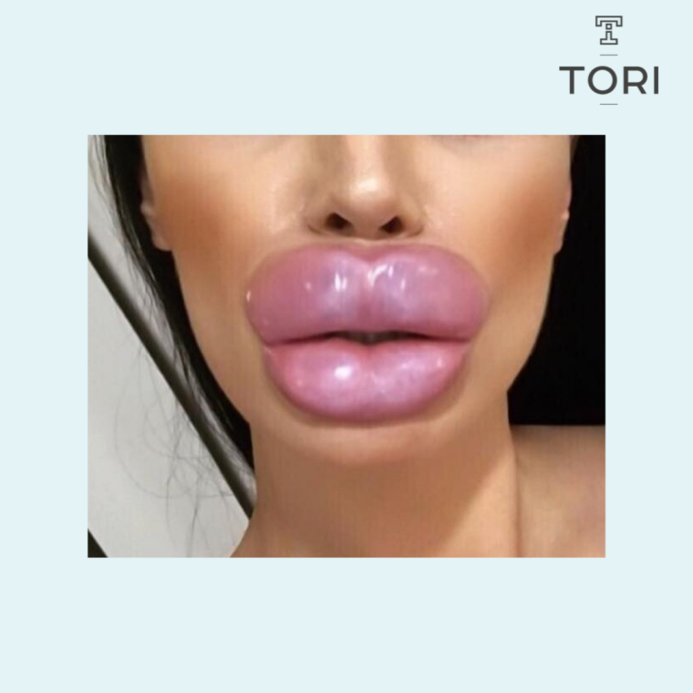 Утка в шубе