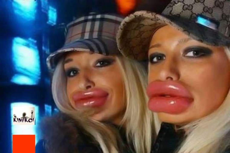 Самые большие накаченные губы