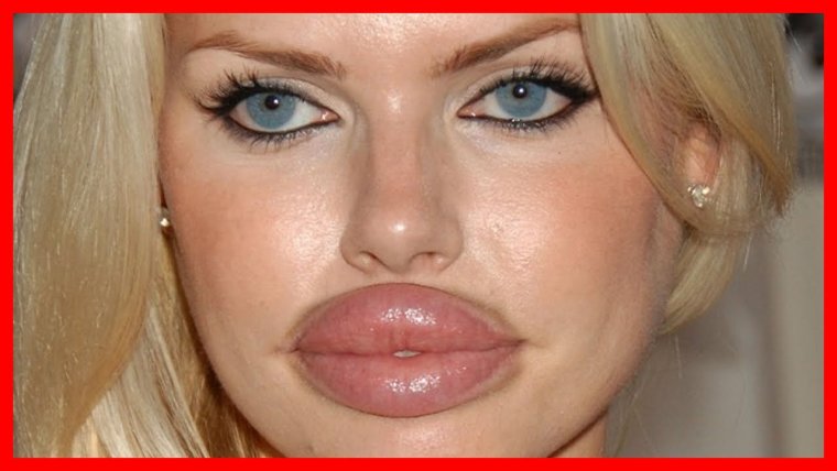 Накаченные губы