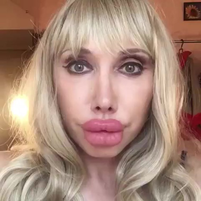 Огромные силиконовые губы