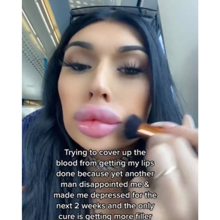 Светлана Давыдова до пластики