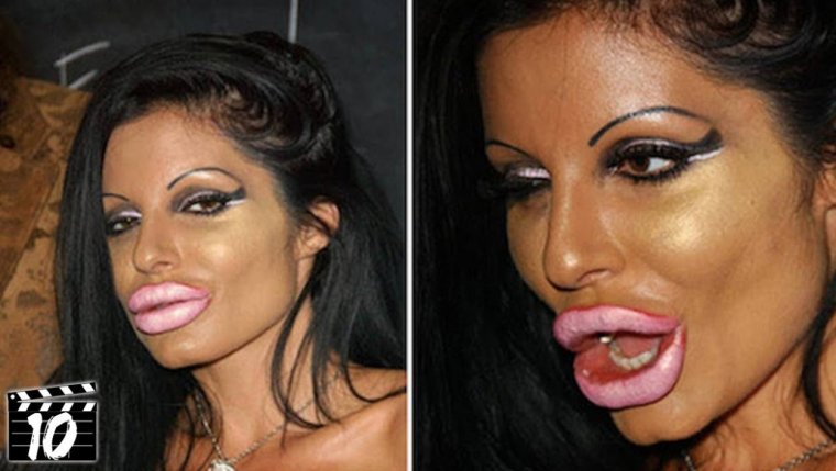 Андреа Эмилова силиконовые губы