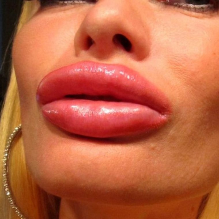 Елена Воробей губы