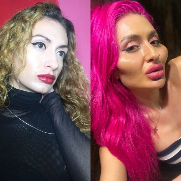 Смешные девушки с накаченными губами