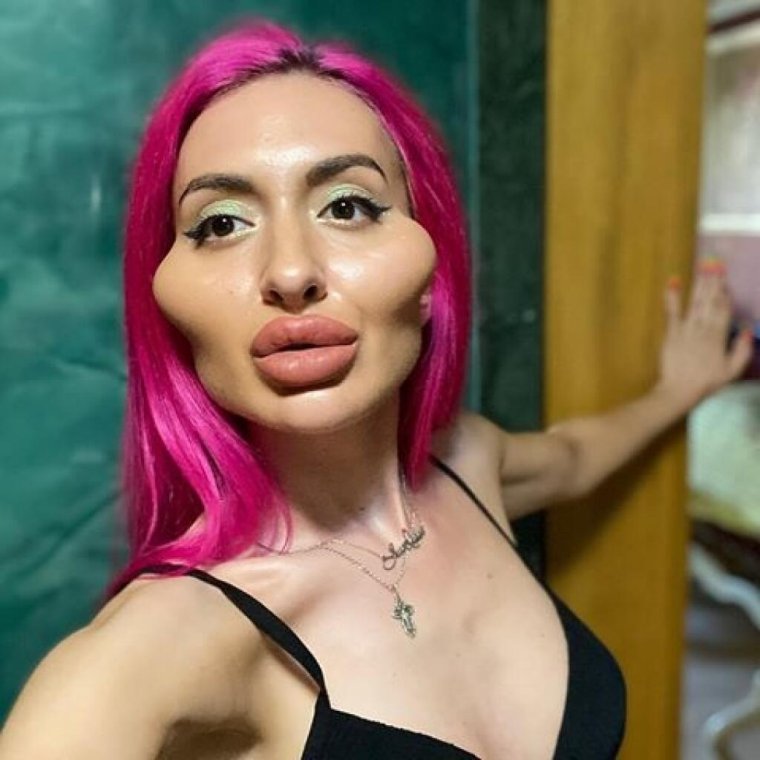 Неудачные пластические операции