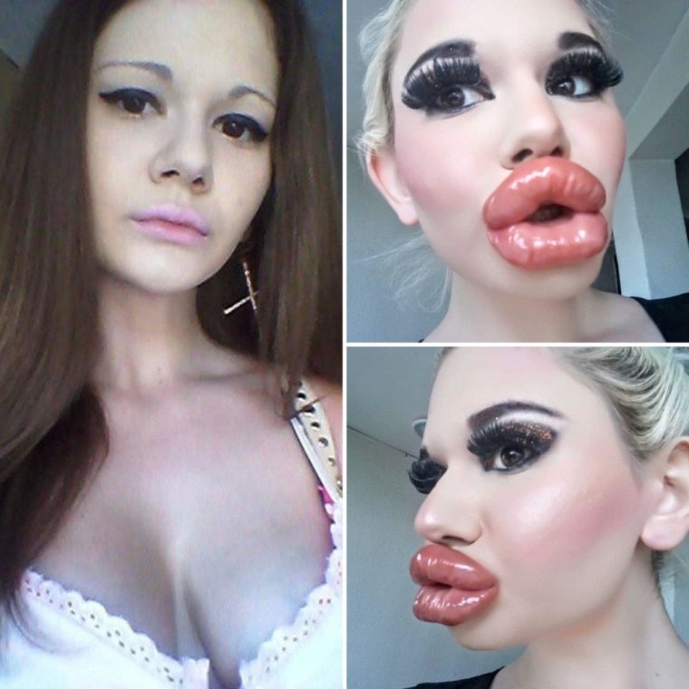 Звезды с надутыми губами