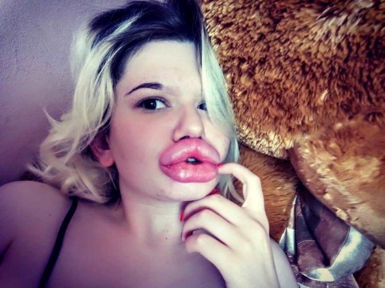 Большие губы