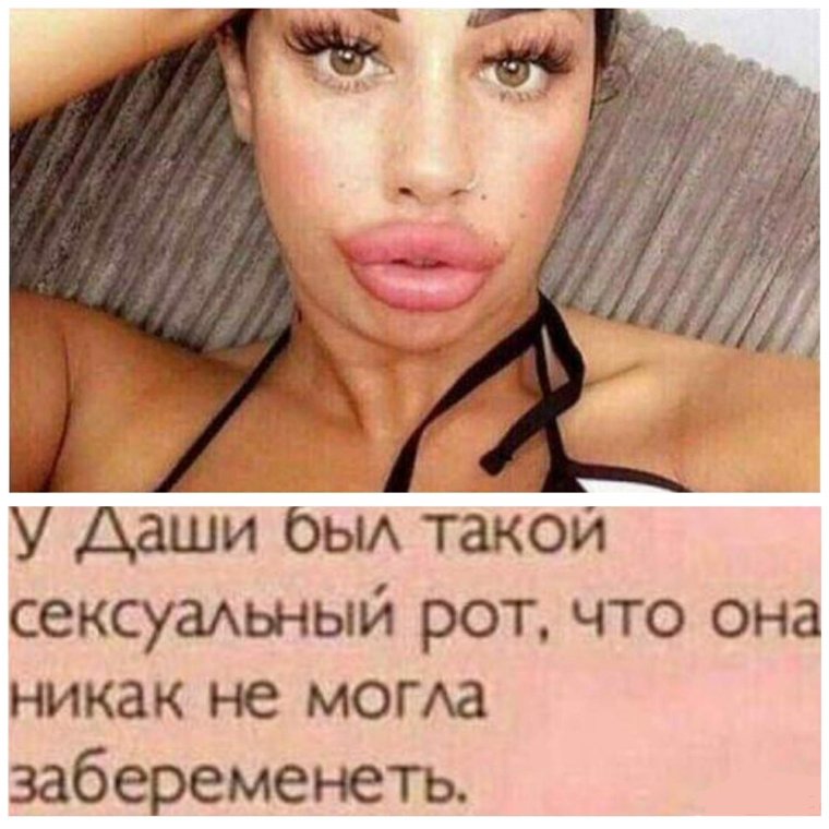 Губы накаченные ботоксом