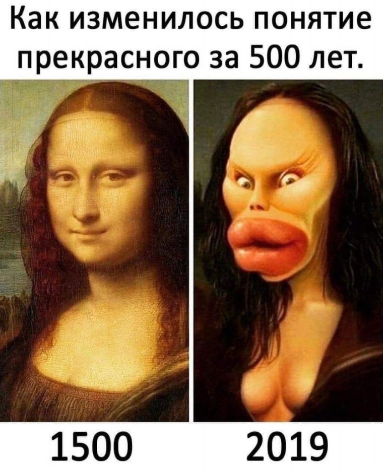 Самые большие силиконовые губы