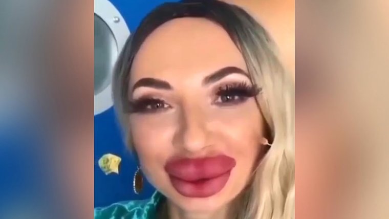 Демотиваторы накачанные губы