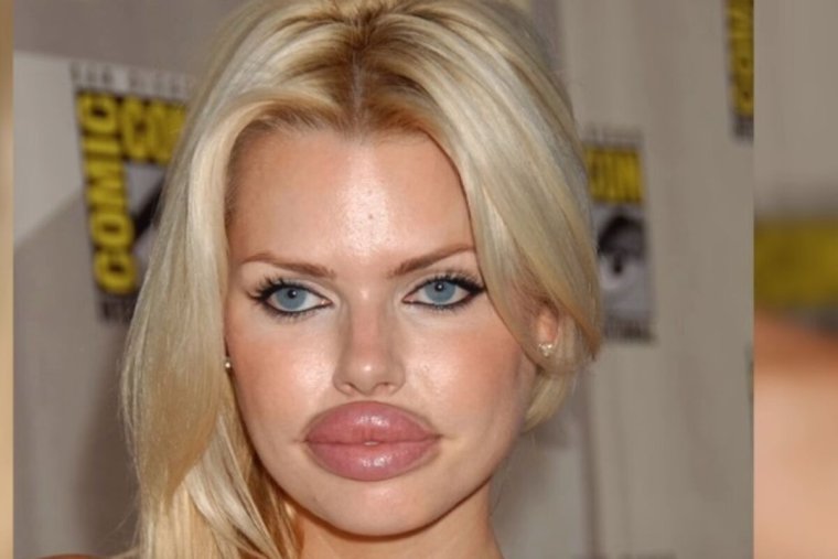 Огромные губы