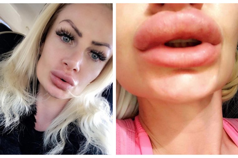 Фарра Абрахам до и после пластики