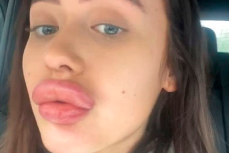 Виктория Уайлд большие губы