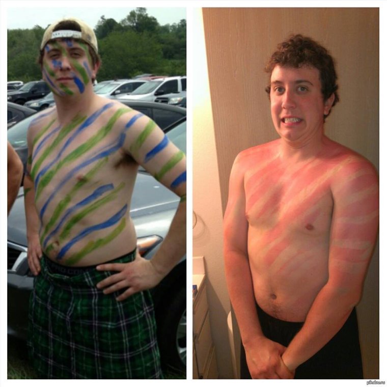 Виды загара