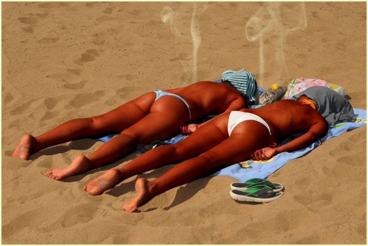 Сильно сгорел на солнце