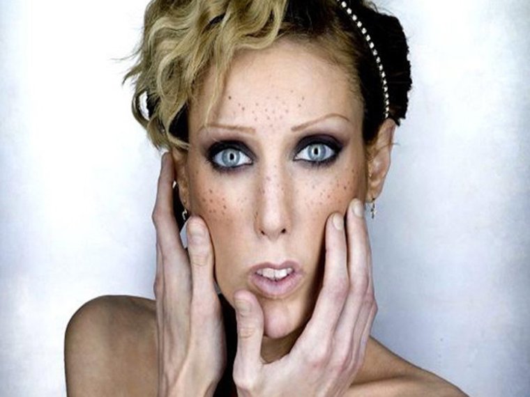 Изабель Каро анорексия