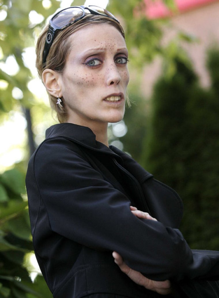 Изабель Каро маленькая девочка которая не хотела толстеть книга